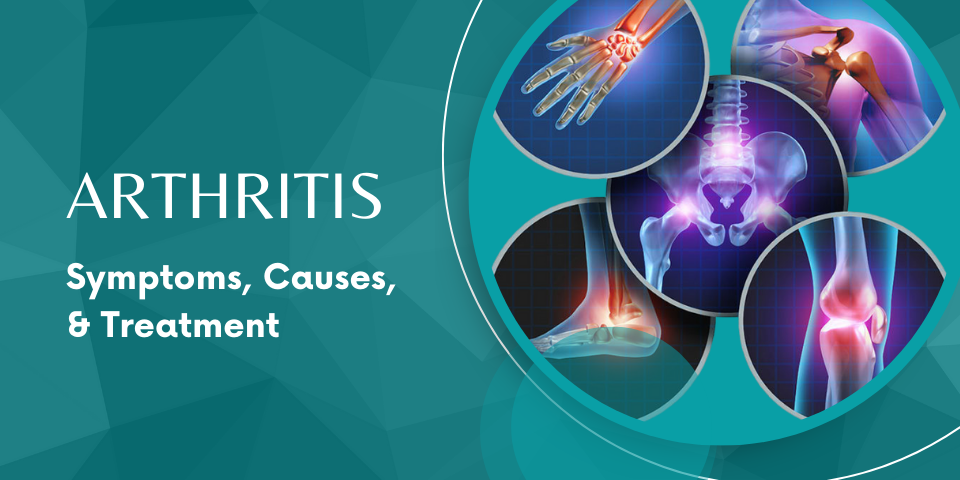 arthritis-symptoms-causes-and-treatment-options-la-elega