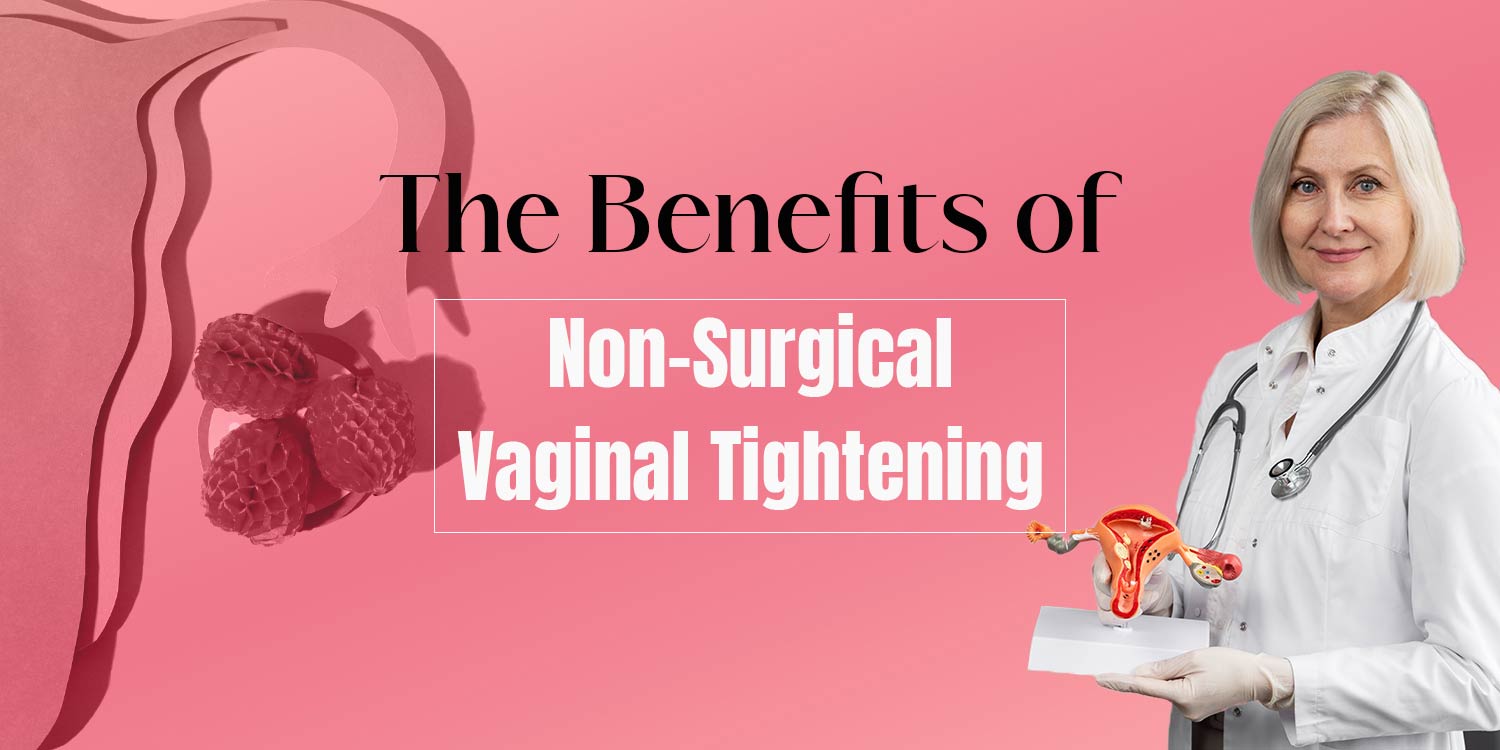 The Benefits of Non-Surgical Vaginal Tightening