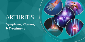 What You Need to Know About Arthritis: Symptoms, Causes, & Treatment