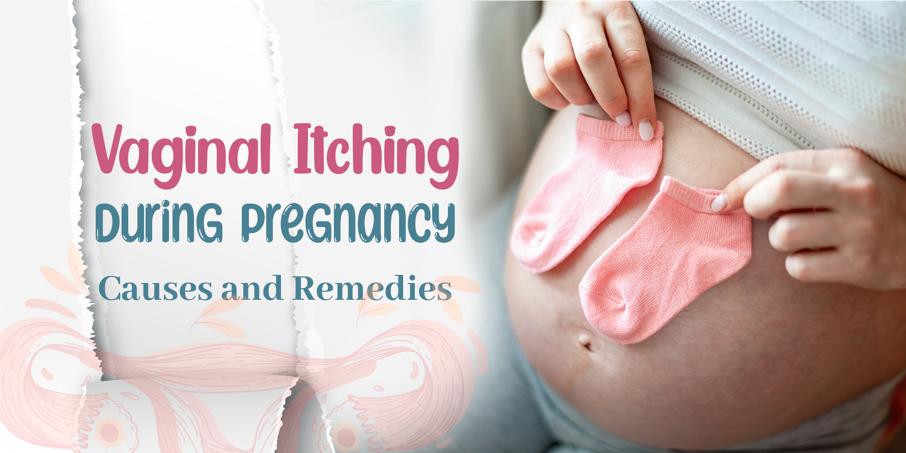 Vaginal Itching During Pregnancy: Causes and Remedies